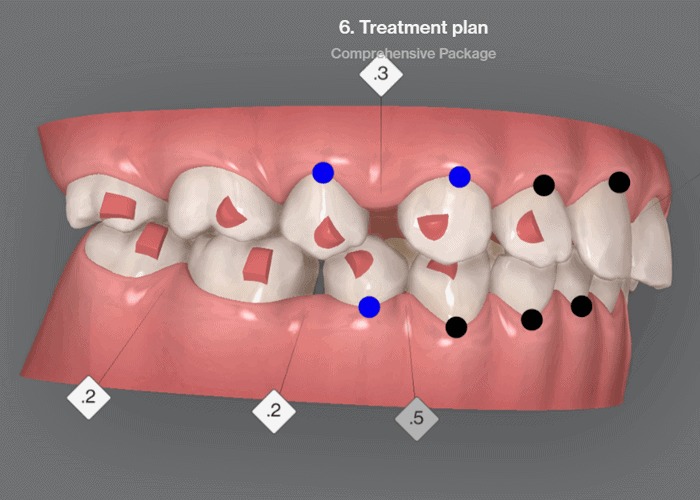 Curso Prático de ClinCheck Invisalign