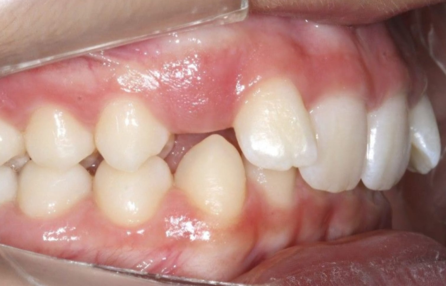 Diagnóstico, Planejamento e Tratamento