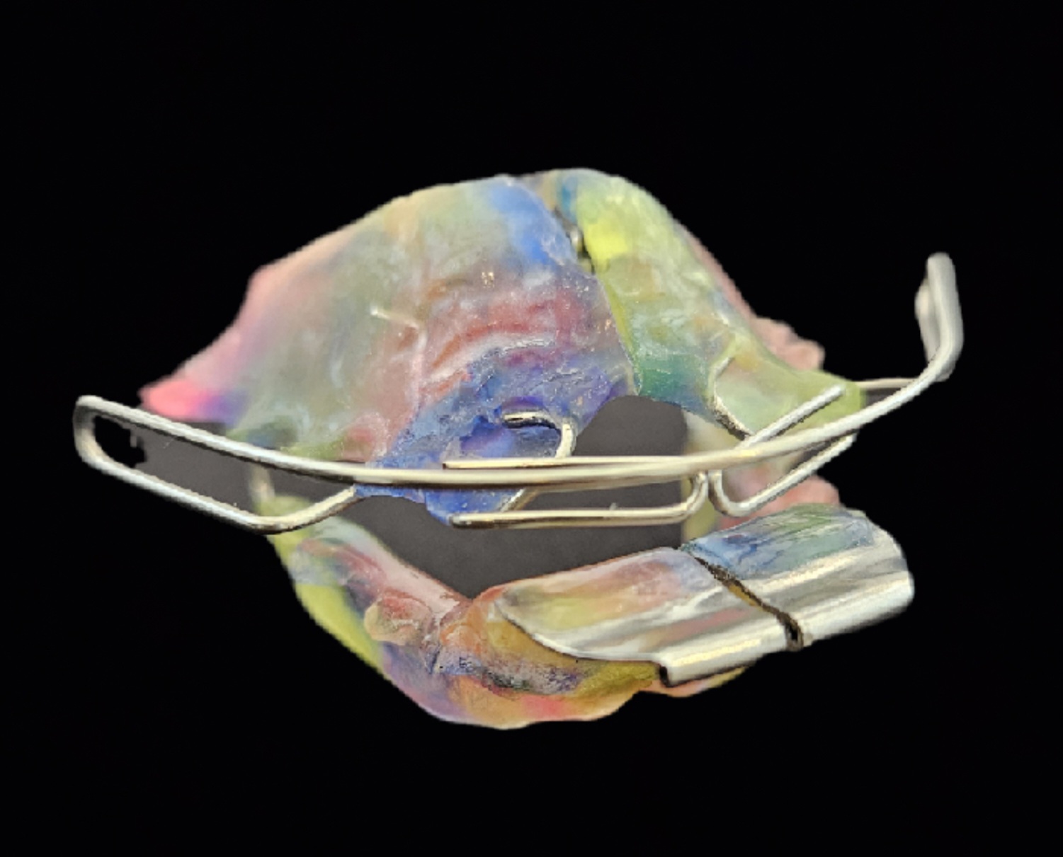 Ortopedia Funcional e Facial dos Maxilares - Turma 4